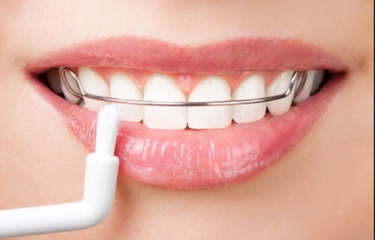 胶南牙齿冷光美白电话/黄岛沈氏口腔